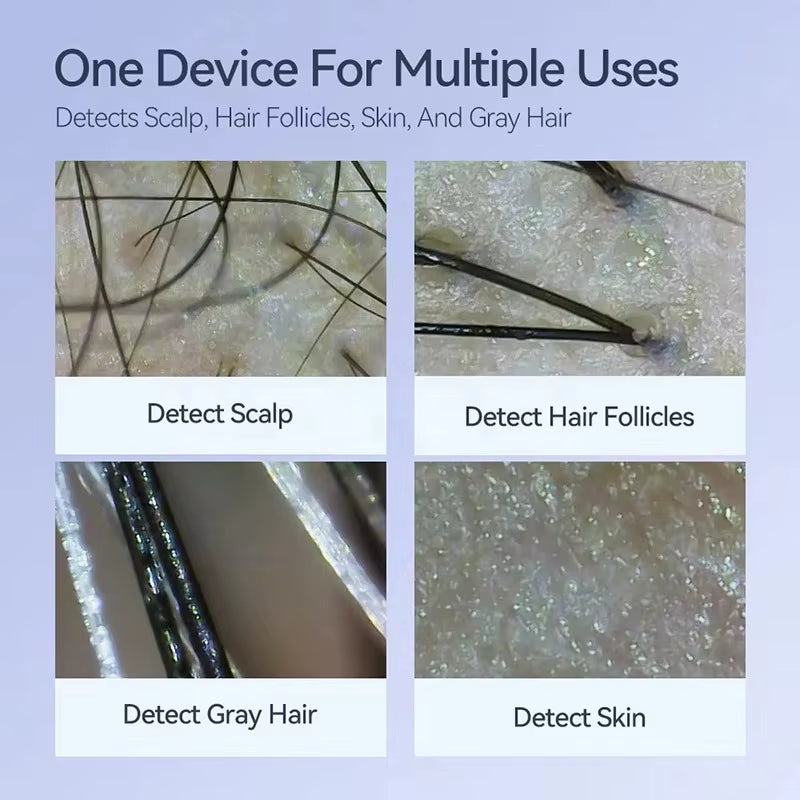 Electron Dermatoscope Scalp Camera Detection Professional Facial Skin Analyzer Machine Digital Microscope Pores Magnifier NEW