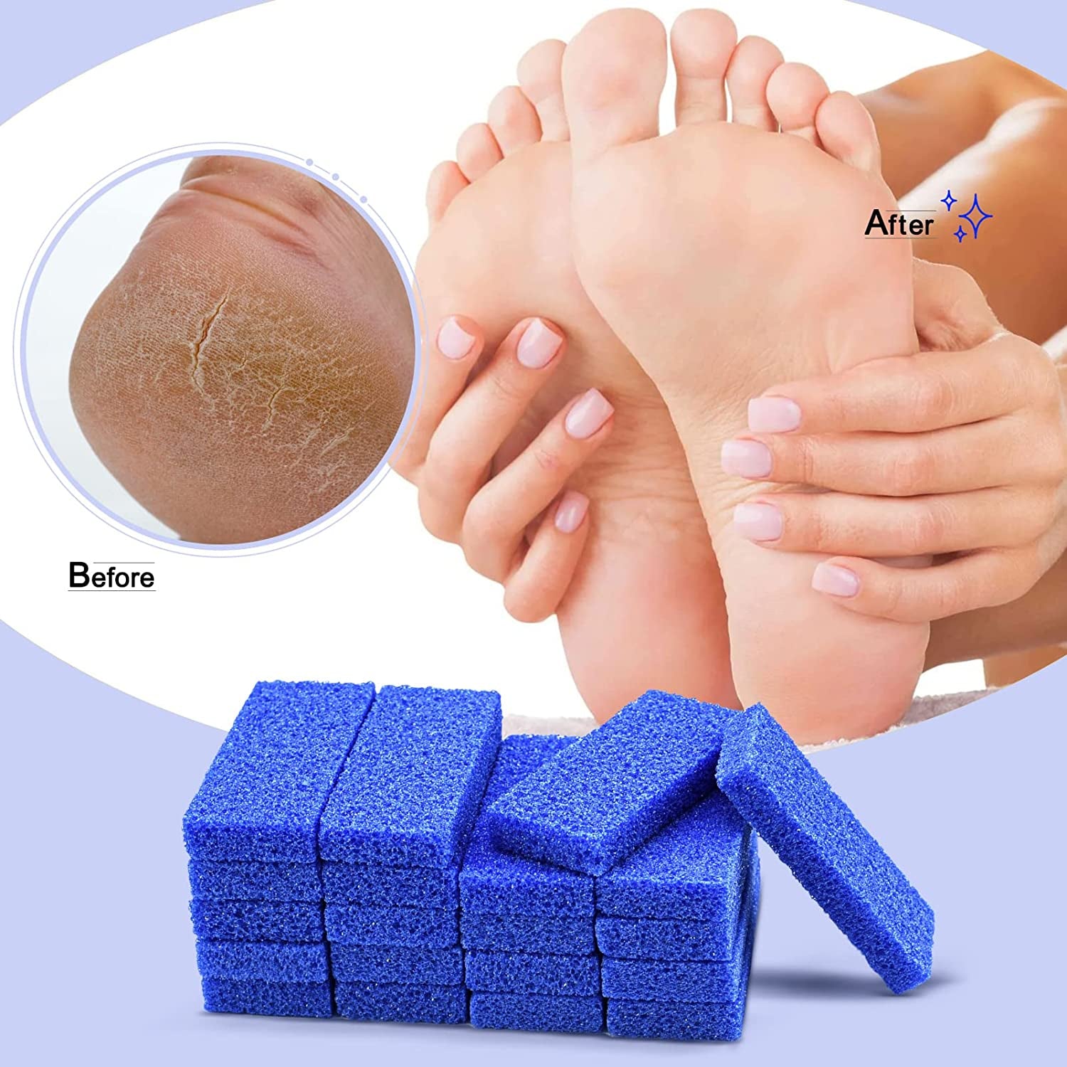 Disposable Foot Scrubber Sponge Pads Pedicure Pumice Stone for Feet Callus Remover Coarse Blue 40Pcs