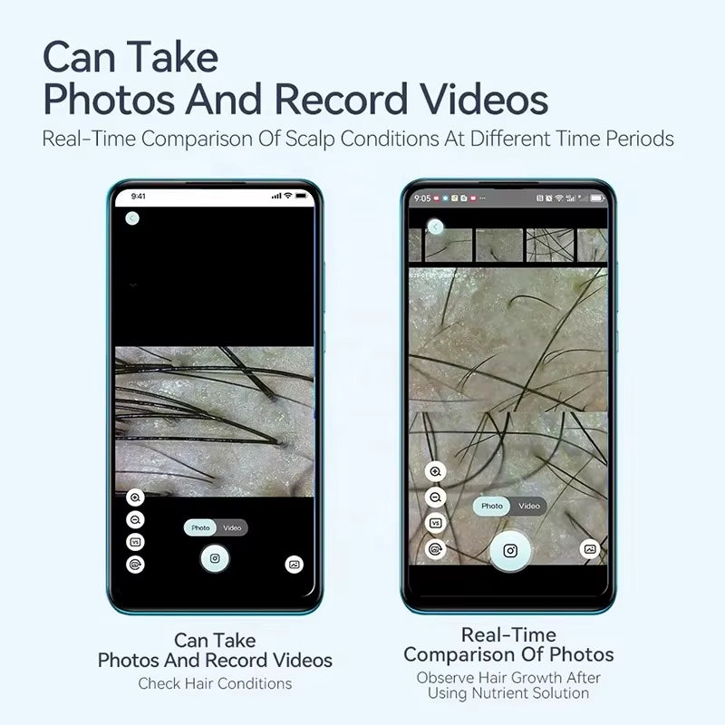 Electron Dermatoscope Scalp Camera Detection Professional Facial Skin Analyzer Machine Digital Microscope Pores Magnifier NEW